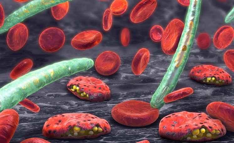 Nine People Die In A Suspected Malaria Outbreak In Marsabit