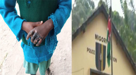 woman burns her children's hands for stealing ksh20