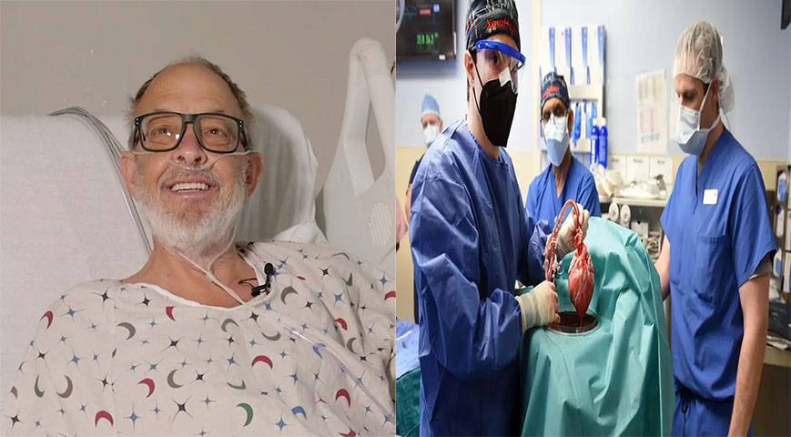 Second Person To Receive Experimental Pig Heart Transplant Dies