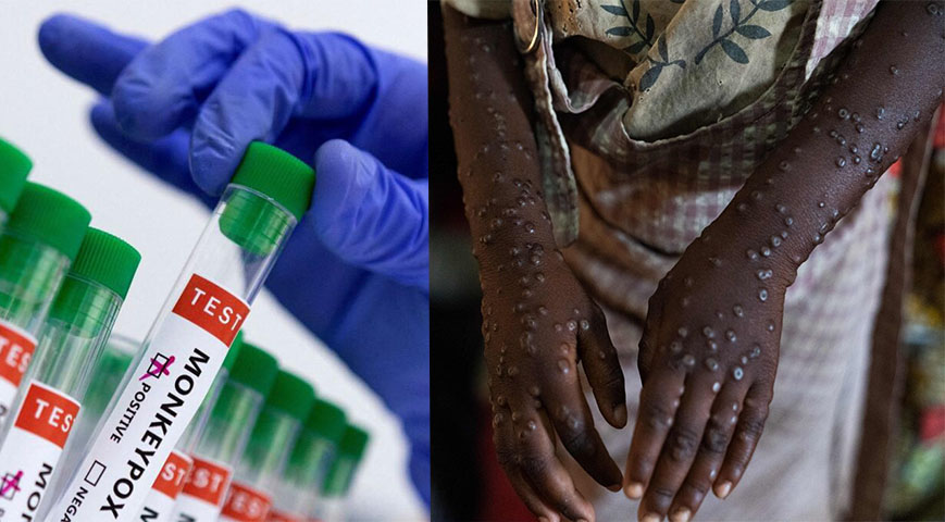 African Countries To Recieve 100,000 Mpox Vaccine Doses From Germany